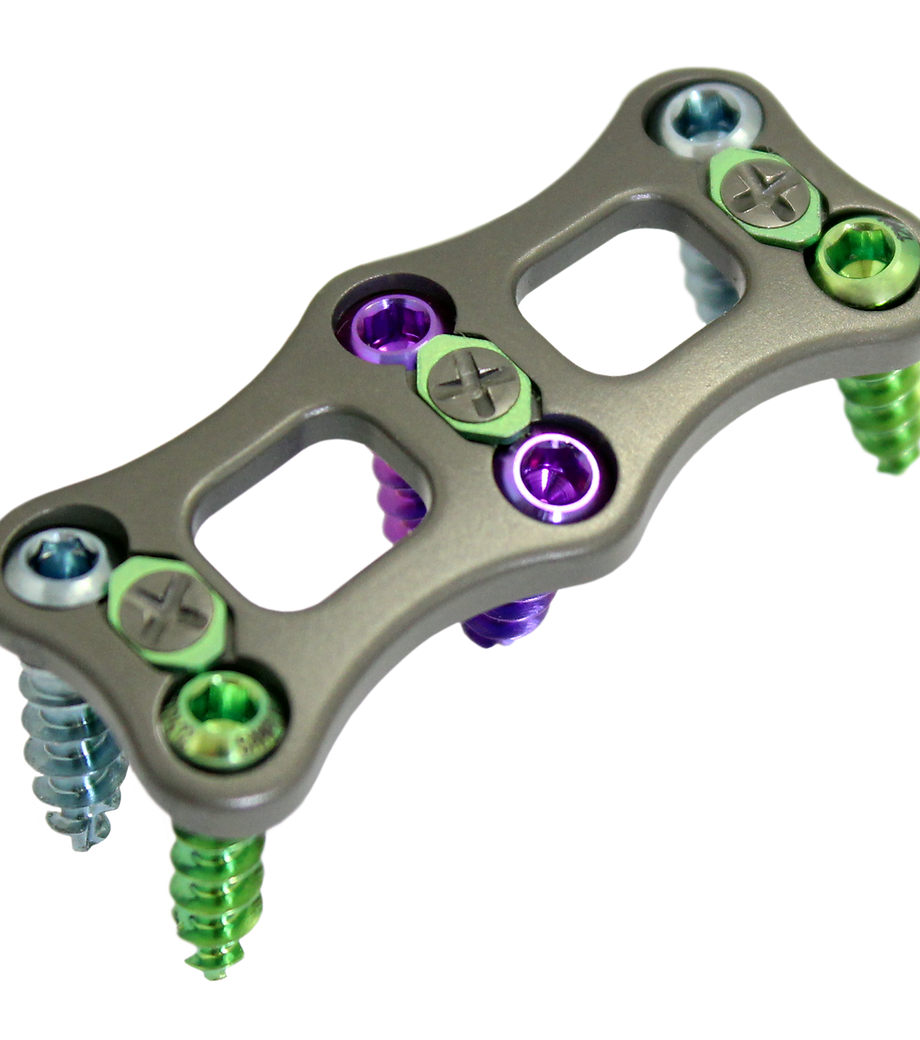 Orthopedic implant 3D design model — Rebellion Solutions product development consulting